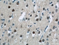 USP11 Rabbit anti-Human, Polyclonal, Proteintech 150 &mu;L; Unconjugated:Antibodies,