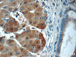USP11 Rabbit anti-Human, Polyclonal, Proteintech 150 &mu;L; Unconjugated:Antibodies,