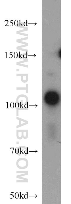 USP11 Rabbit anti-Human, Polyclonal, Proteintech 150 &mu;L; Unconjugated:Antibodies,