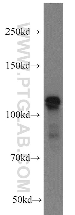 USP11 Rabbit anti-Human, Polyclonal, Proteintech 150 &mu;L; Unconjugated:Antibodies,