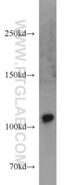 USP11 Rabbit anti-Human, Polyclonal, Proteintech 150 &mu;L; Unconjugated:Antibodies,