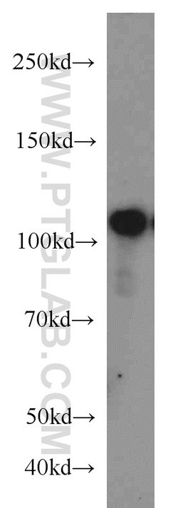 USP11 Rabbit anti-Human, Polyclonal, Proteintech 150 &mu;L; Unconjugated:Antibodies,