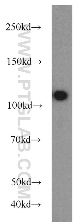 USP11 Rabbit anti-Human, Polyclonal, Proteintech 150 &mu;L; Unconjugated:Antibodies,