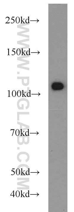 USP11 Rabbit anti-Human, Polyclonal, Proteintech 150 &mu;L; Unconjugated:Antibodies,