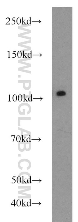 USP11 Rabbit anti-Human, Polyclonal, Proteintech 150 &mu;L; Unconjugated:Antibodies,