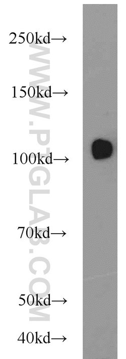 USP11 Rabbit anti-Human, Polyclonal, Proteintech 150 &mu;L; Unconjugated:Antibodies,