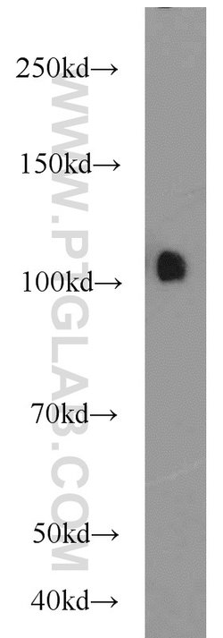 USP11 Rabbit anti-Human, Polyclonal, Proteintech 150 &mu;L; Unconjugated:Antibodies,