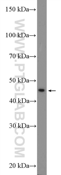 L-VEGFA Rabbit anti-Human, Polyclonal, Proteintech 150 &mu;L | Buy Online | Proteintech Group Inc | Fisher Scientific