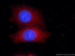 TBX2 Rabbit anti-Human, Mouse, Polyclonal, Proteintech 150 &mu;L; Unconjugated:Antibodies,