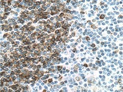 CD79A Rabbit anti-Human, Polyclonal, Proteintech:Antibodies:Primary Antibodies