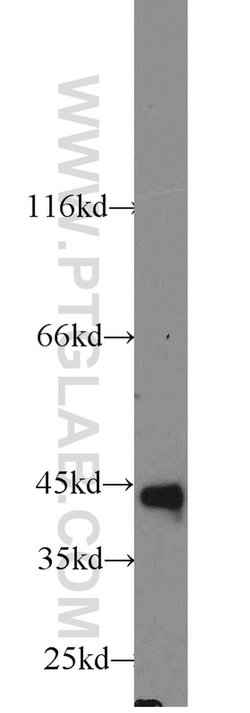 CD79A Rabbit anti-Human, Polyclonal, Proteintech:Antibodies:Primary Antibodies