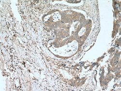 MIG Rabbit anti-Human, Polyclonal, Proteintech:Antibodies:Primary Antibodies