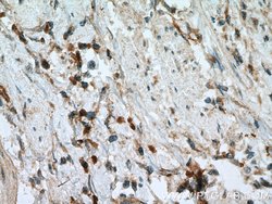 MIG Rabbit anti-Human, Polyclonal, Proteintech:Antibodies:Primary Antibodies