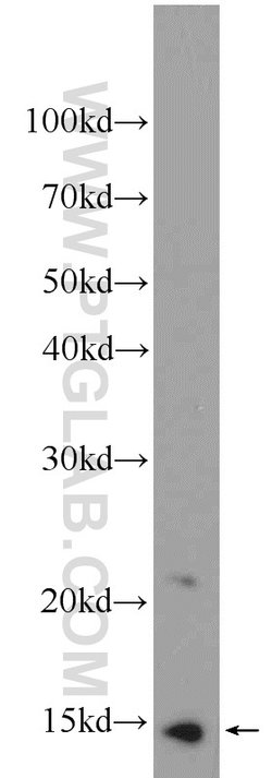 MIG Rabbit anti-Human, Polyclonal, Proteintech:Antibodies:Primary Antibodies