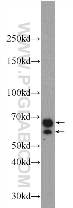 CXorf15 Rabbit anti-Human, Mouse, Polyclonal, Proteintech 150 &mu;L | Buy Online | Proteintech Group Inc | Fisher Scientific