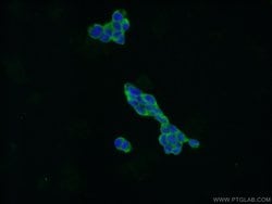 CXorf15 Rabbit anti-Human, Mouse, Polyclonal, Proteintech 150 &mu;L | Buy Online | Proteintech Group Inc | Fisher Scientific