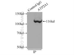 ATP2A1 Rabbit anti-Human, Mouse, Polyclonal, Proteintech:Antibodies:Primary