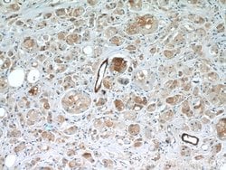 BRCA1 Rabbit anti-Human, Polyclonal, Proteintech 150 &mu;L; Unconjugated:Antibodies,