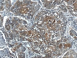 BRCA1 Rabbit anti-Human, Polyclonal, Proteintech 150 &mu;L; Unconjugated:Antibodies,