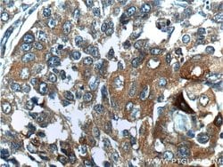 BRCA1 Rabbit anti-Human, Polyclonal, Proteintech 150 &mu;L; Unconjugated:Antibodies,