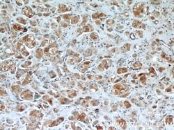 BRCA1 Rabbit anti-Human, Polyclonal, Proteintech 150 &mu;L; Unconjugated:Antibodies,