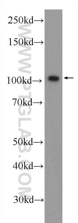 BRCA1 Rabbit anti-Human, Polyclonal, Proteintech 150 &mu;L; Unconjugated:Antibodies,