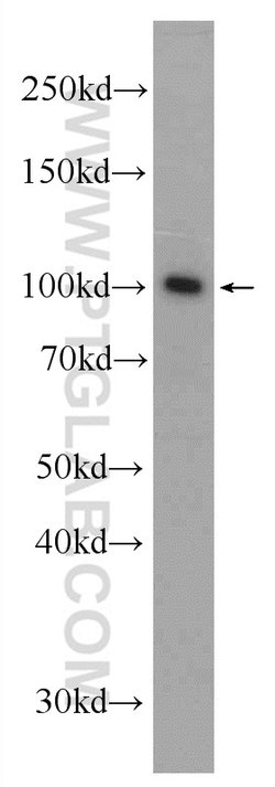 BRCA1 Rabbit anti-Human, Polyclonal, Proteintech 150 &mu;L; Unconjugated:Antibodies,