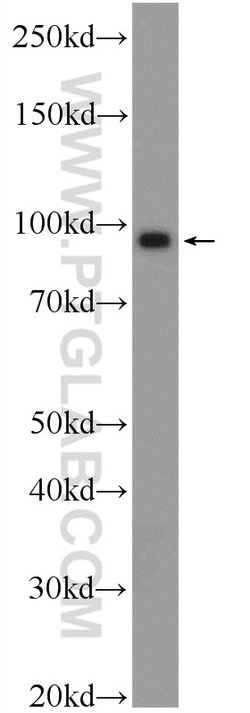BRCA1 Rabbit anti-Human, Polyclonal, Proteintech 150 &mu;L; Unconjugated:Antibodies,