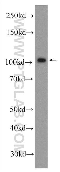 BRCA1 Rabbit anti-Human, Polyclonal, Proteintech 150 &mu;L; Unconjugated:Antibodies,