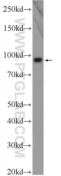 BRCA1 Rabbit anti-Human, Polyclonal, Proteintech 150 &mu;L; Unconjugated:Antibodies,