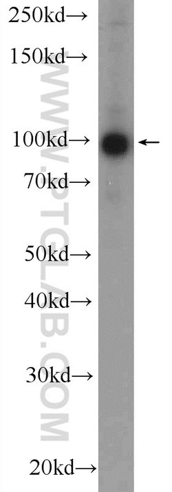 BRCA1 Rabbit anti-Human, Polyclonal, Proteintech 150 &mu;L; Unconjugated:Antibodies,