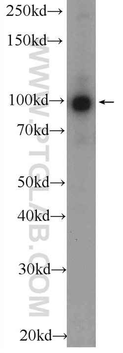 BRCA1 Rabbit anti-Human, Polyclonal, Proteintech 150 &mu;L; Unconjugated:Antibodies,
