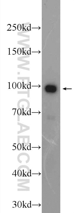 BRCA1 Rabbit anti-Human, Polyclonal, Proteintech 150 &mu;L; Unconjugated:Antibodies,