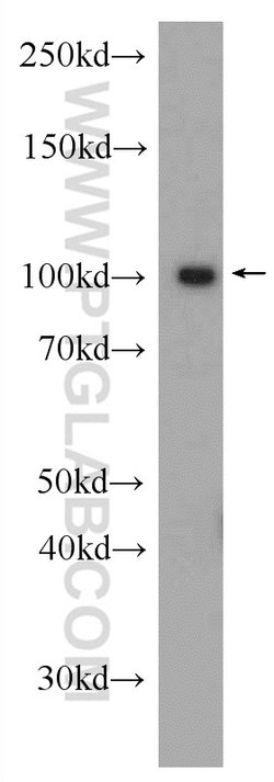 BRCA1 Rabbit anti-Human, Polyclonal, Proteintech 150 &mu;L; Unconjugated:Antibodies,