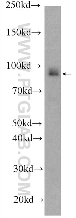 BRCA1 Rabbit anti-Human, Polyclonal, Proteintech 150 &mu;L; Unconjugated:Antibodies,