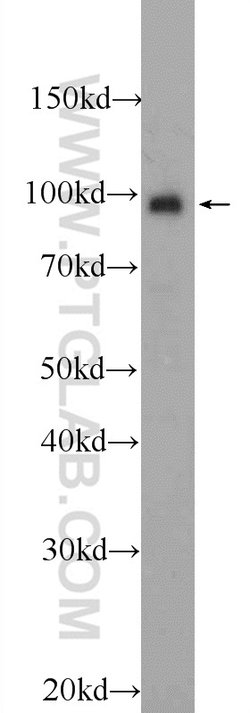 BRCA1 Rabbit anti-Human, Polyclonal, Proteintech 150 &mu;L; Unconjugated:Antibodies,