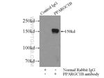 Thumbnail_PPARGC1B Rabbit anti-Human, Mouse, Polyclonal, Proteintech 150 &mu;L; Unconjugated:Antibodies