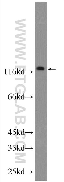 TTI1 Rabbit anti-Human, Polyclonal, Proteintech:Antibodies:Primary Antibodies