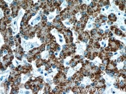 AGXT Rabbit anti-Human, Mouse, Polyclonal, Proteintech 150 &mu;L; Unconjugated:Antibodies,