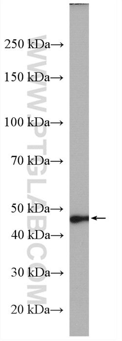 AGXT Rabbit anti-Human, Mouse, Polyclonal, Proteintech 150 &mu;L; Unconjugated:Antibodies,