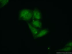 Syntenin-1 Rabbit anti-Human, Polyclonal, Proteintech:Antibodies:Primary