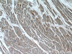 Syntenin-1 Rabbit anti-Human, Polyclonal, Proteintech:Antibodies:Primary