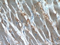 Syntenin-1 Rabbit anti-Human, Polyclonal, Proteintech:Antibodies:Primary