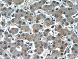 Syntenin-1 Rabbit anti-Human, Polyclonal, Proteintech:Antibodies:Primary