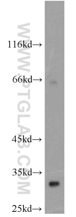 Syntenin-1 Rabbit anti-Human, Polyclonal, Proteintech:Antibodies:Primary