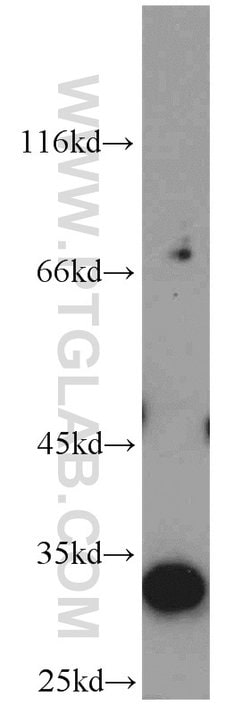 Syntenin-1 Rabbit anti-Human, Polyclonal, Proteintech:Antibodies:Primary