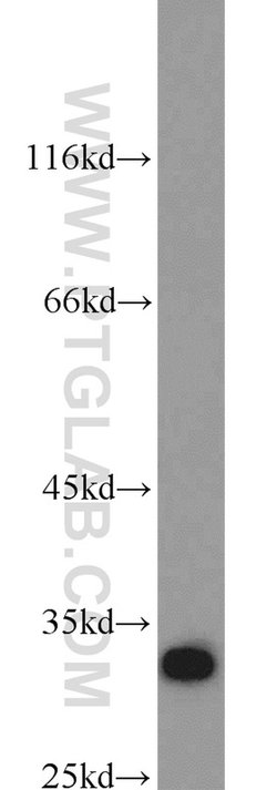 Syntenin-1 Rabbit anti-Human, Polyclonal, Proteintech:Antibodies:Primary