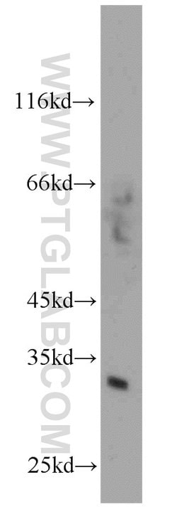 Syntenin-1 Rabbit anti-Human, Polyclonal, Proteintech:Antibodies:Primary