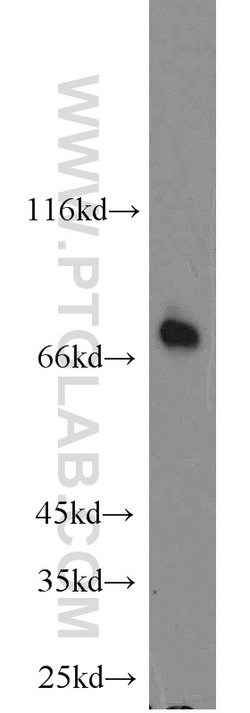 ACSL4/FACL4 Rabbit anti-Human, Polyclonal, Proteintech 150 &mu;L; Unconjugated:Antibodies,