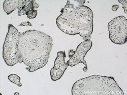 ACSL4/FACL4 Rabbit anti-Human, Polyclonal, Proteintech 150 &mu;L; Unconjugated:Antibodies,